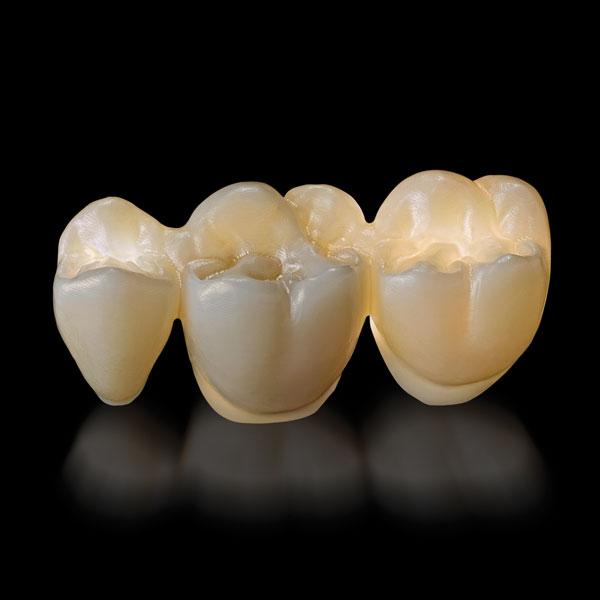 Multilayered Zirconia from NobelProcera