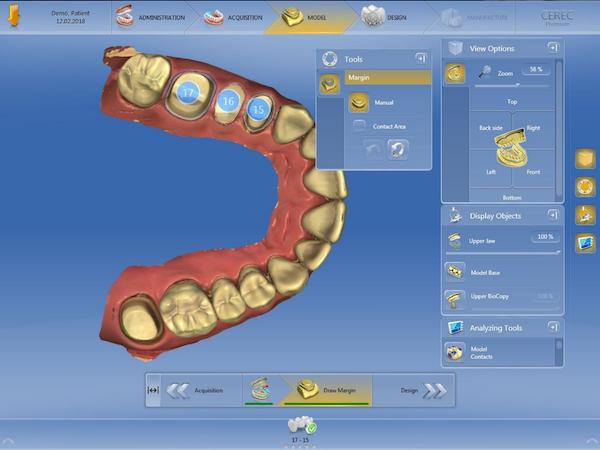 CEREC Premium Software 4.5